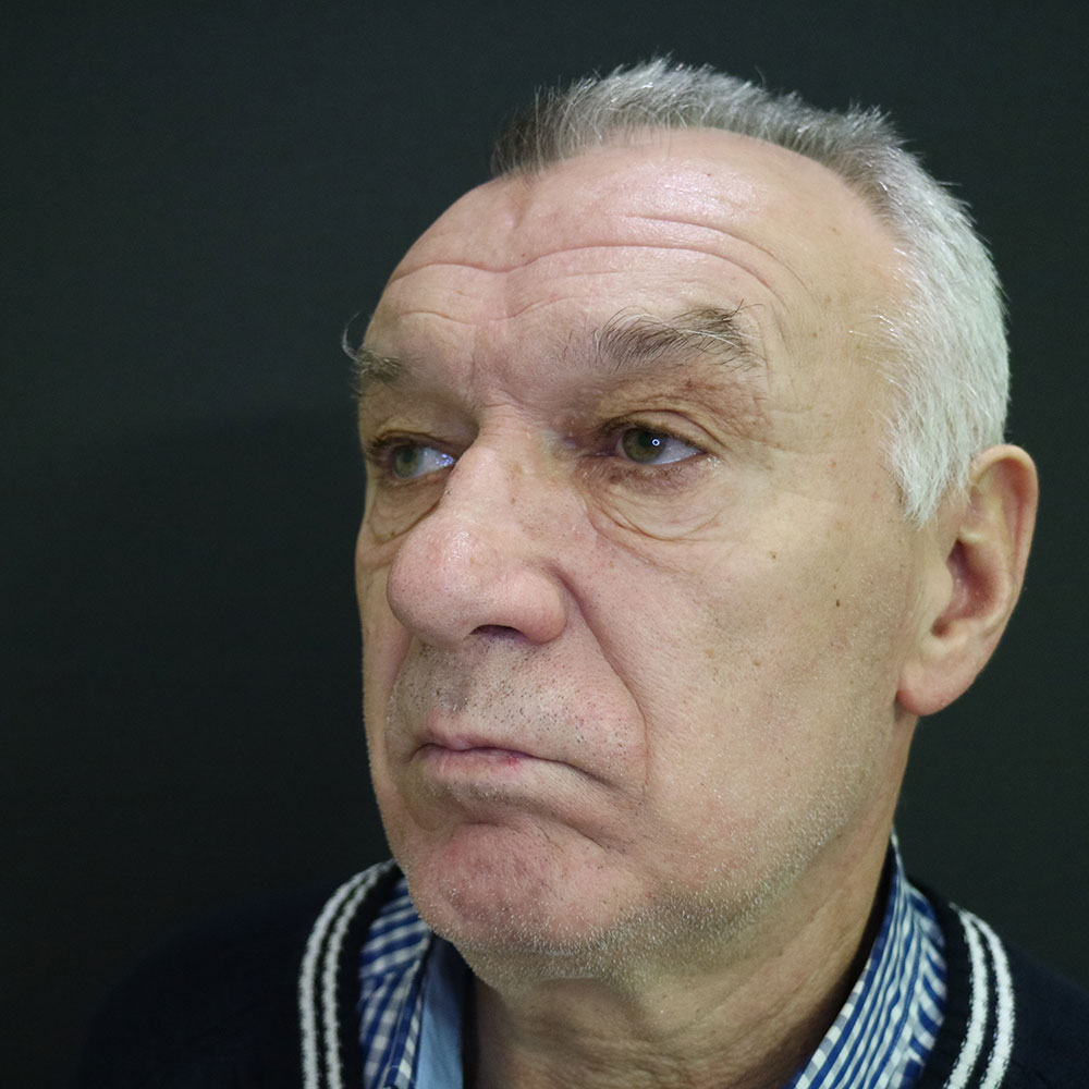 Блефаропластика — до